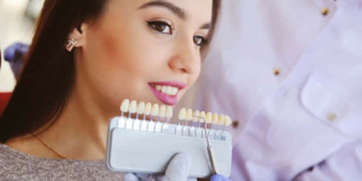 Are Dental Veneers Painful? The Truth Behind the Procedure