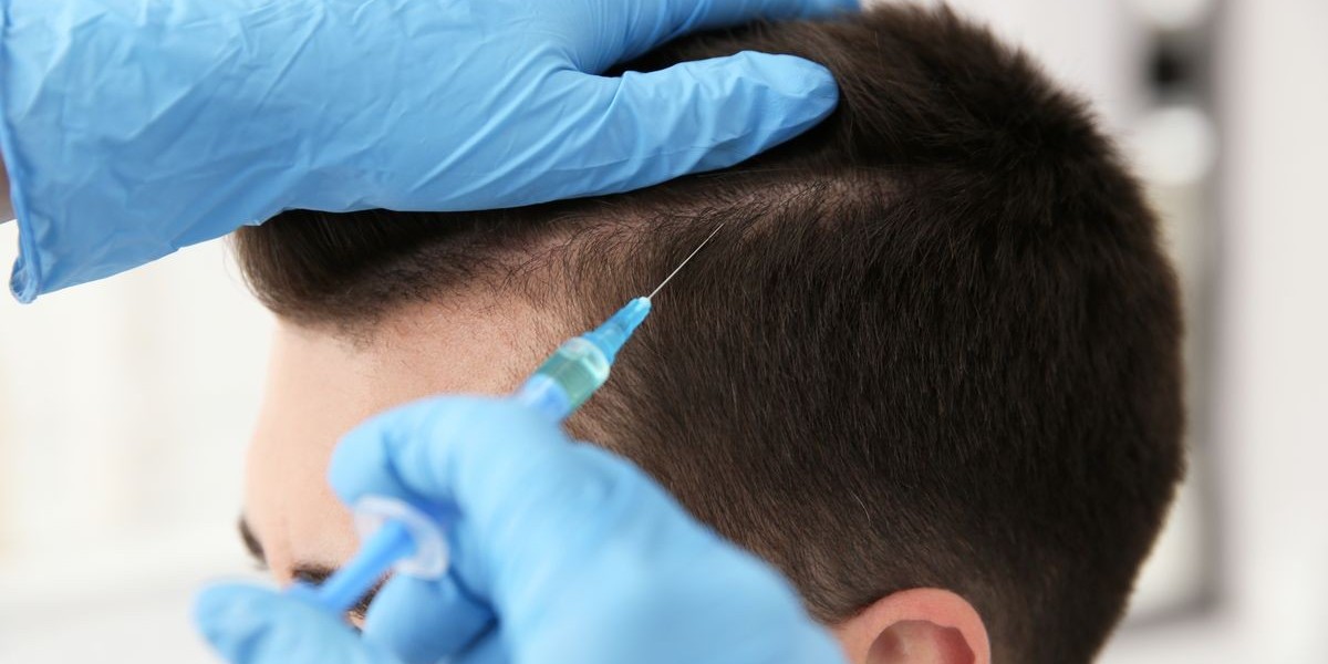 PRP Hair Treatment: Riyadh Patient Stories