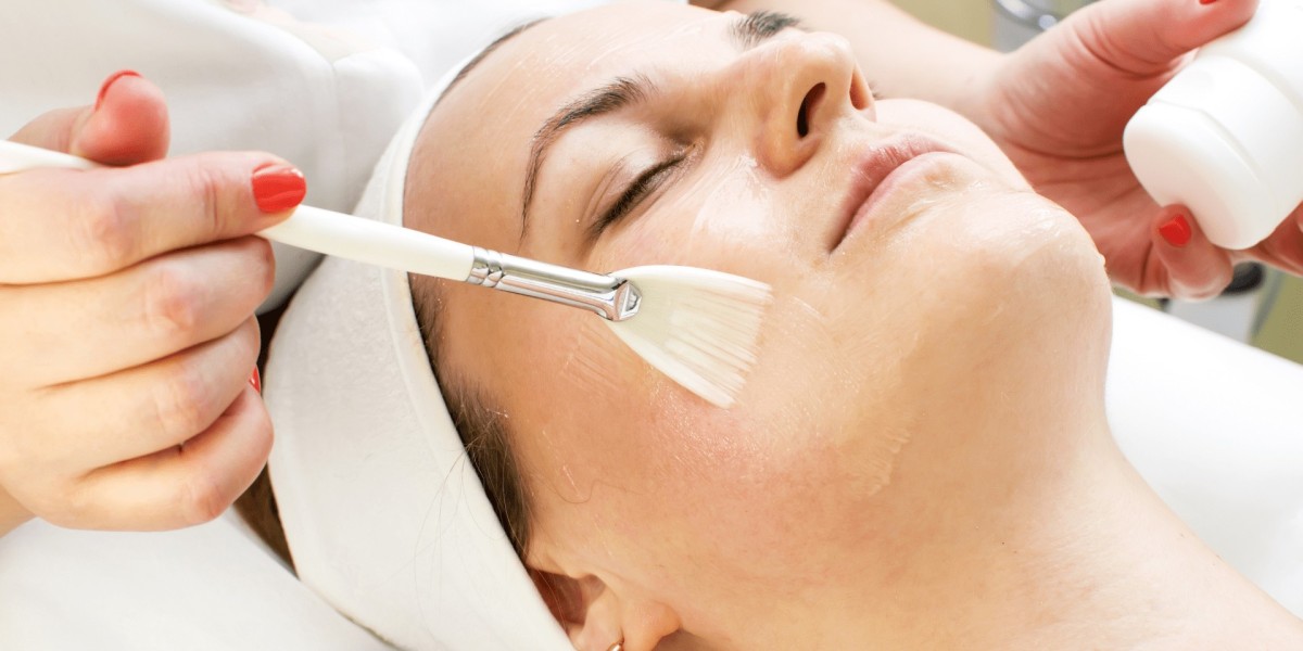 Can a Glycolic Acid Peel Remove Dark Spots Fast?