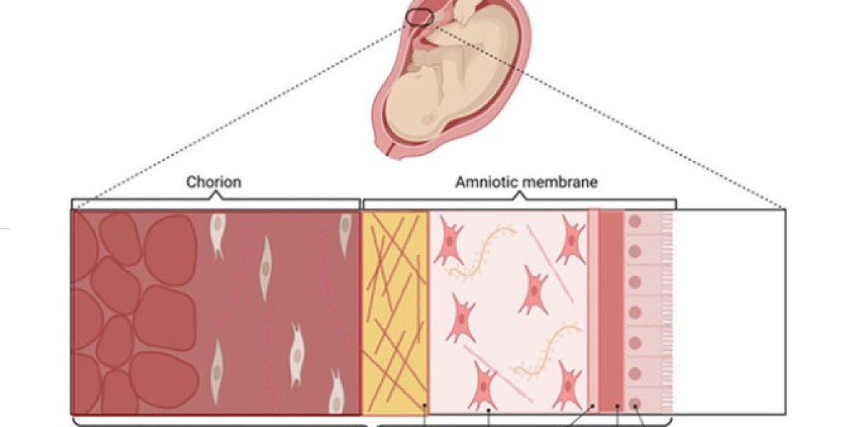 Amniotic Allografts: Advancing the Future of Wound Healing