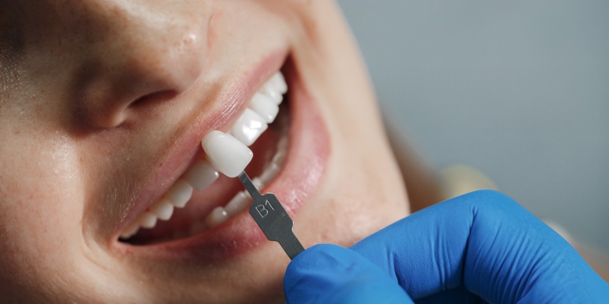 Veneers Dentist in Bahrain – Aesthetica Dr. Reem AlShaiba Dental Center
