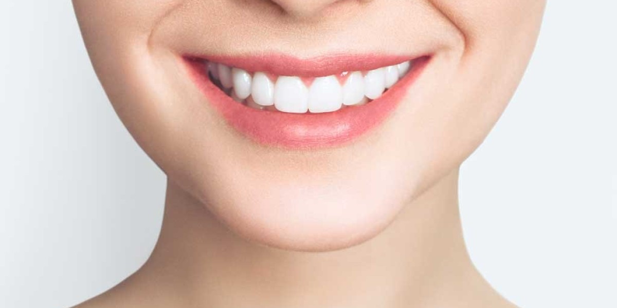 Teeth Whitening for Brides and Grooms: Smile Perfectly on Your Big Day