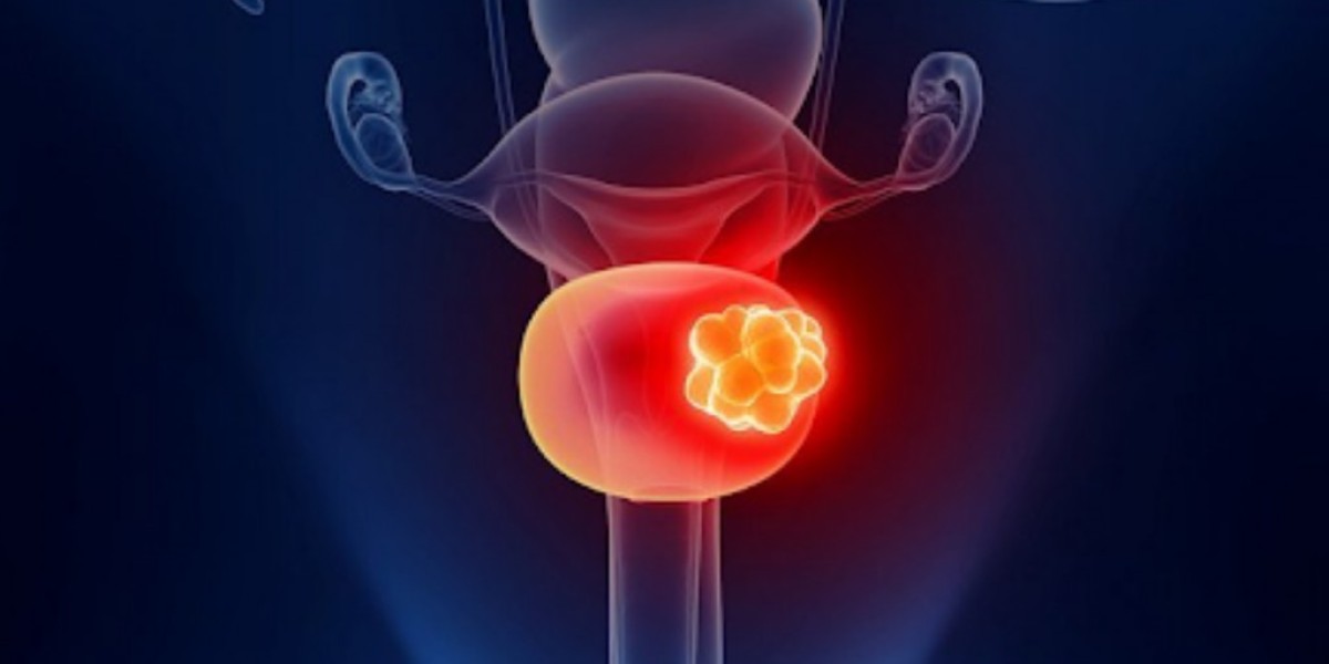 Kidney Stone Treatment in Jaipur: Cost, Procedure, and Recovery