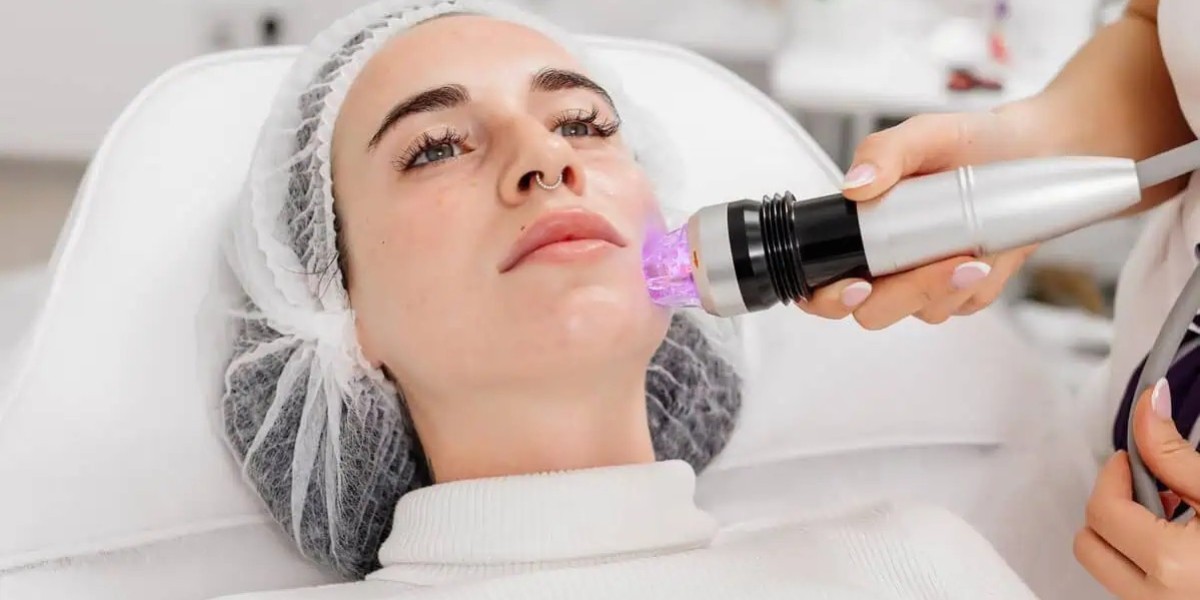 Max Out Your Glow With Fractional RF Microneedling Tech