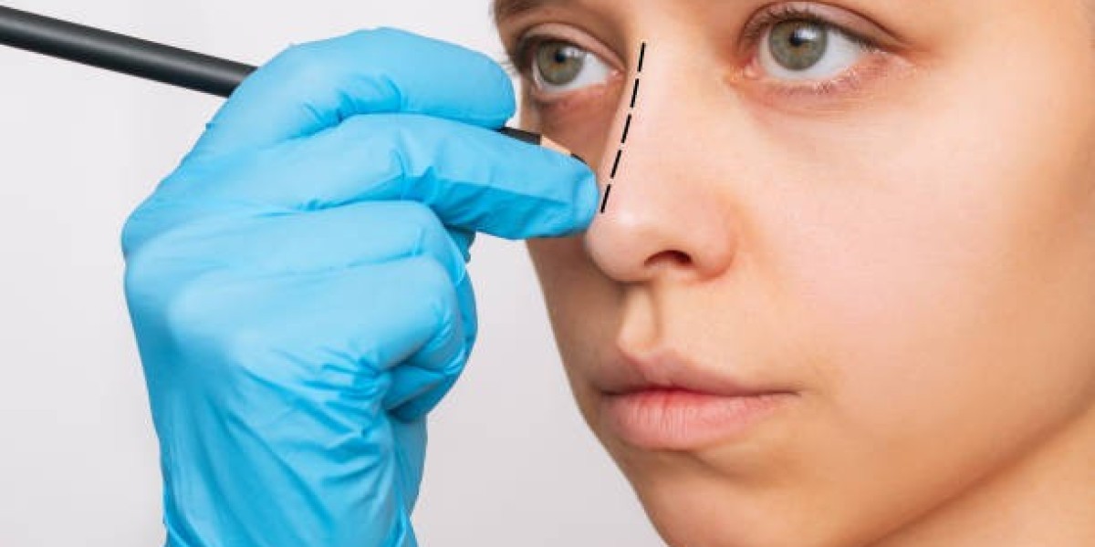 أفضل أطباء تجميل الأنف في الرياض مع تقييمات حقيقية