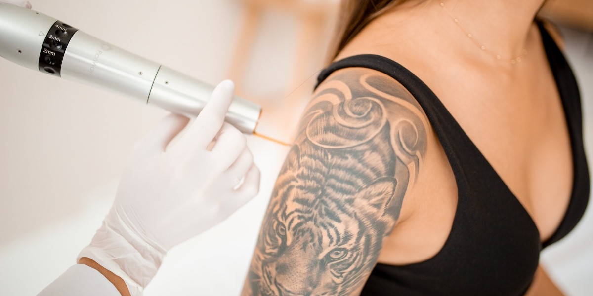 Laser Tattoo Removal in Dubai for Your Skin Comeback