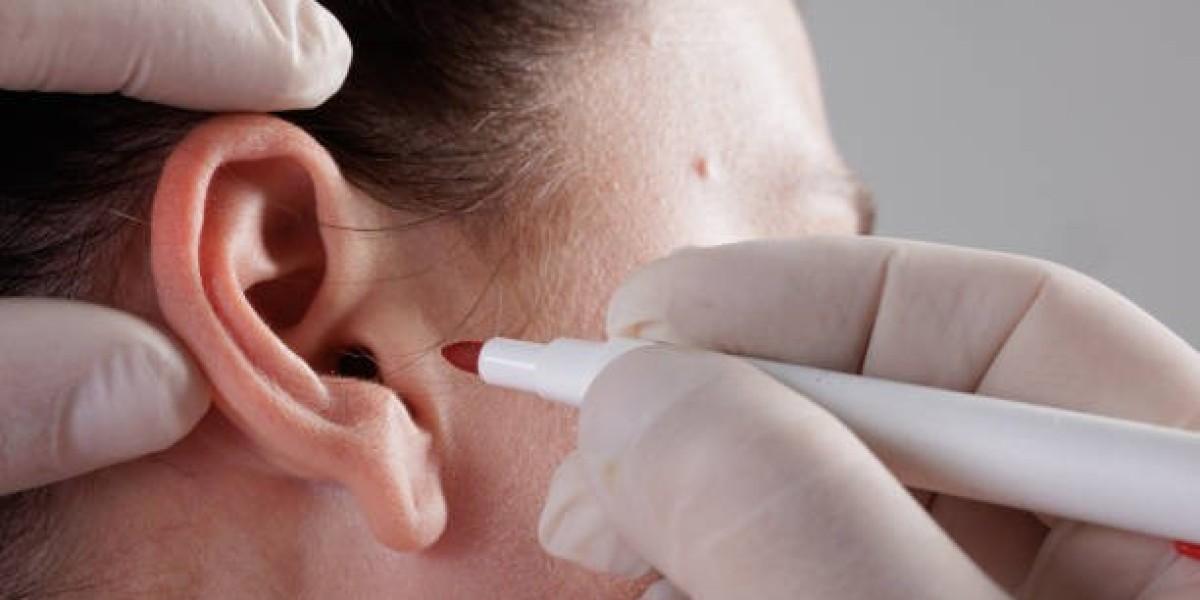 قبل وبعد جراحة تجميل الأذن في الرياض: صور حقيقية