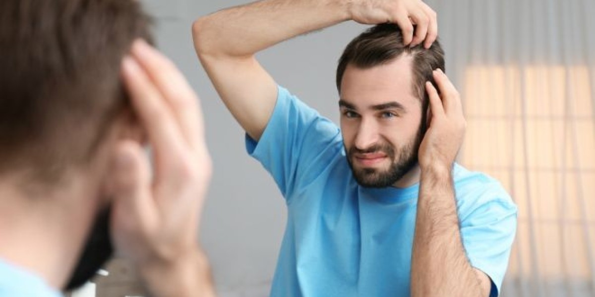 Patient Stories: Hair Transplants in Riyadh Clinics