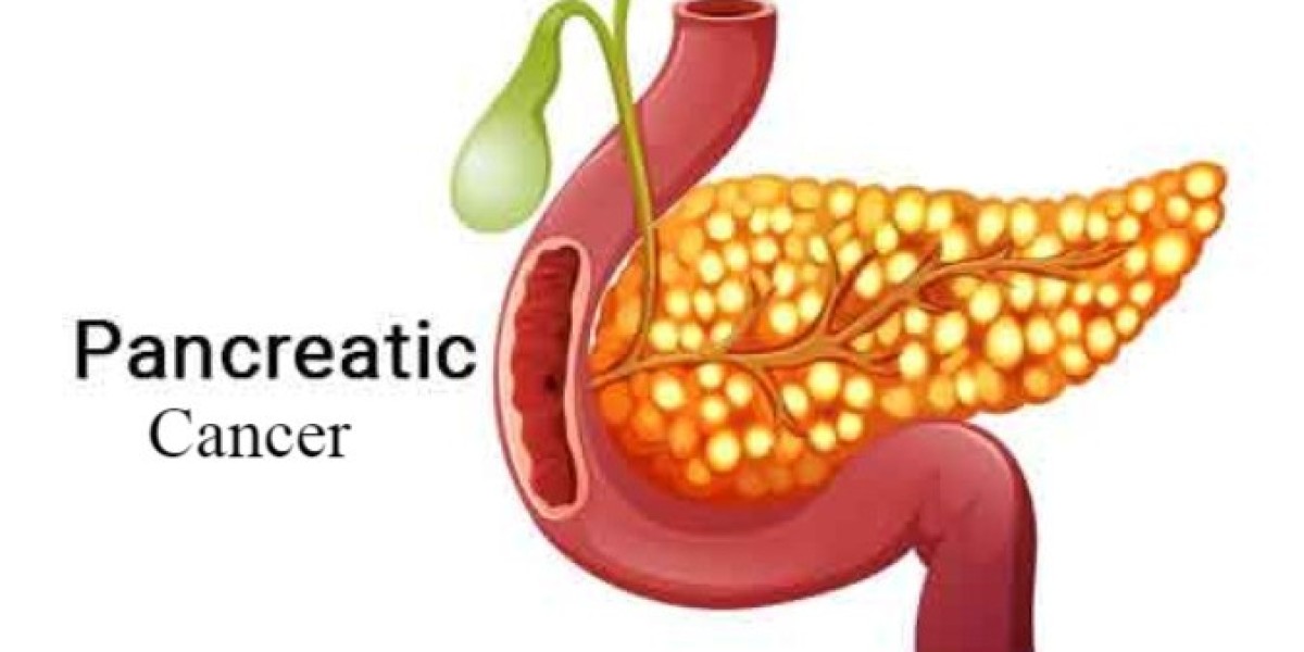 Pancreatic Cancer Diagnostic Market: Trends, Innovations, and Growth Outlook (2024-2032)