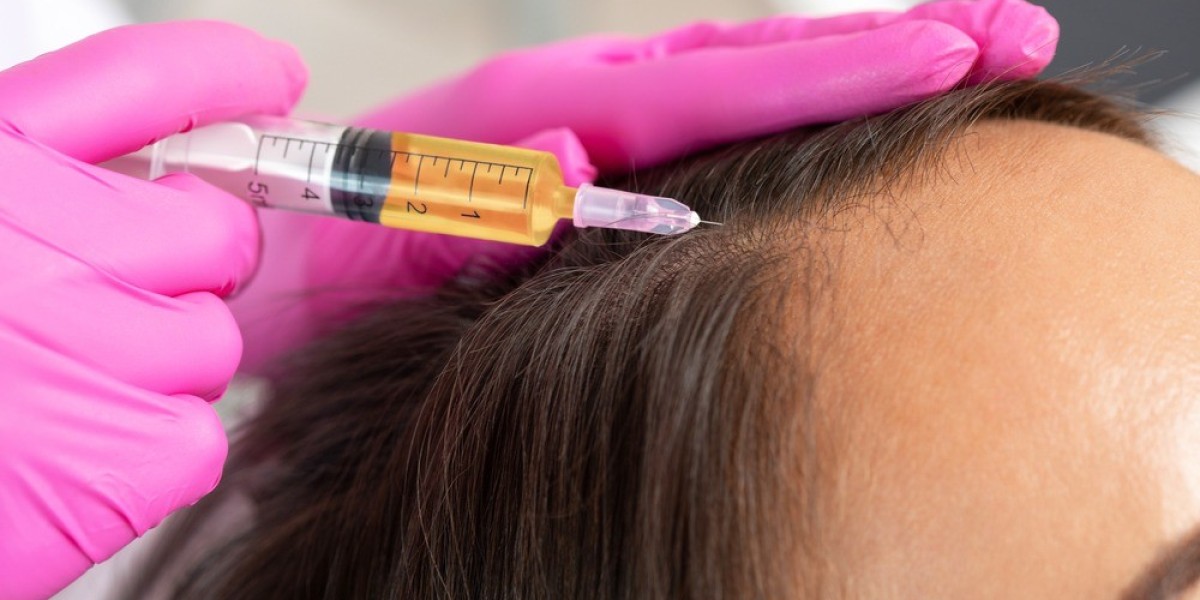 How Effective Is Stem Cell Hair Transplant For Baldness?