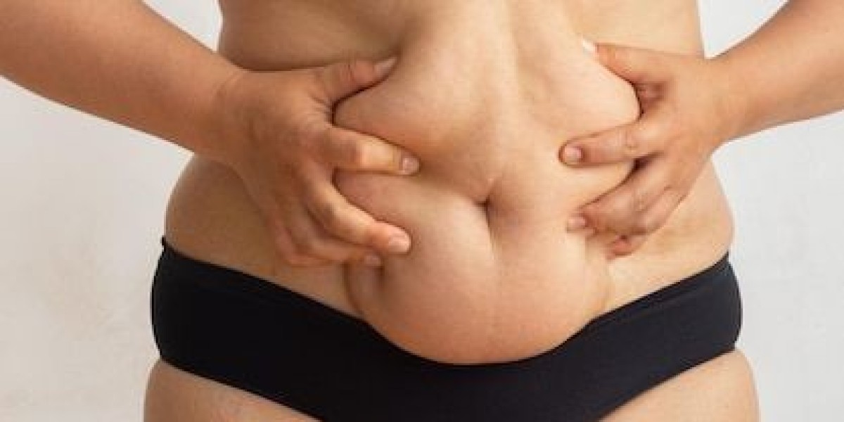 Lipo Abdominoplasty in Riyadh: Restore Confidence & Contour