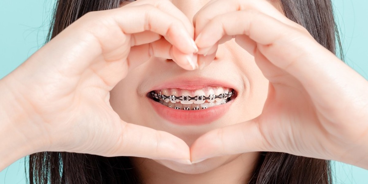 Will braces change my facial appearance?