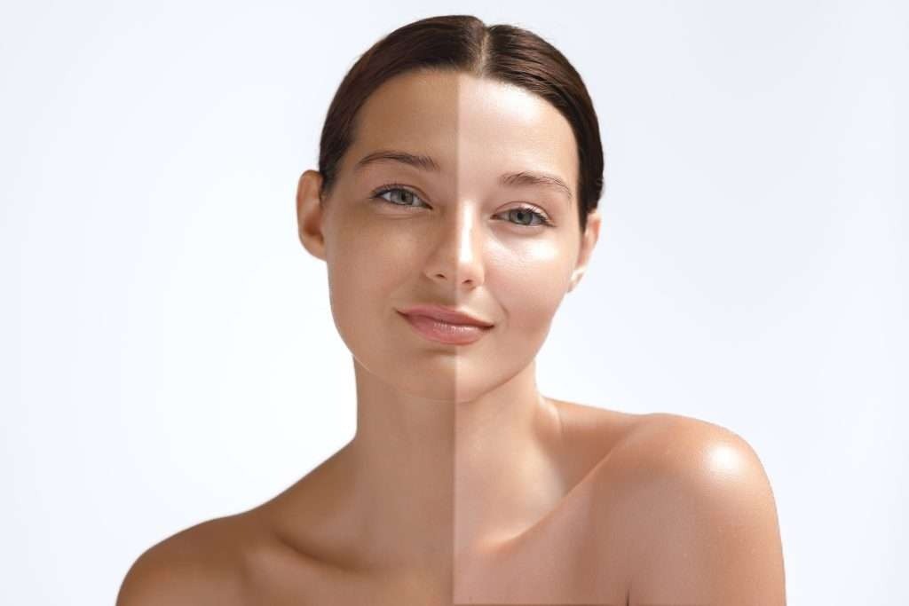 Permanent Skin Whitening Injection