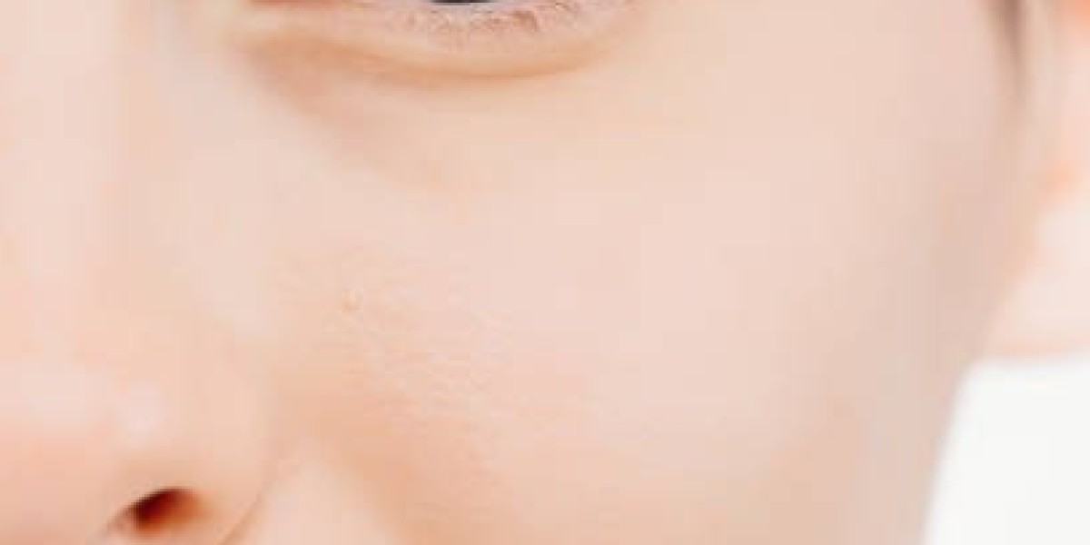 Post-Alarplasty Care Tips to Ensure Fast Healing in Riyadh