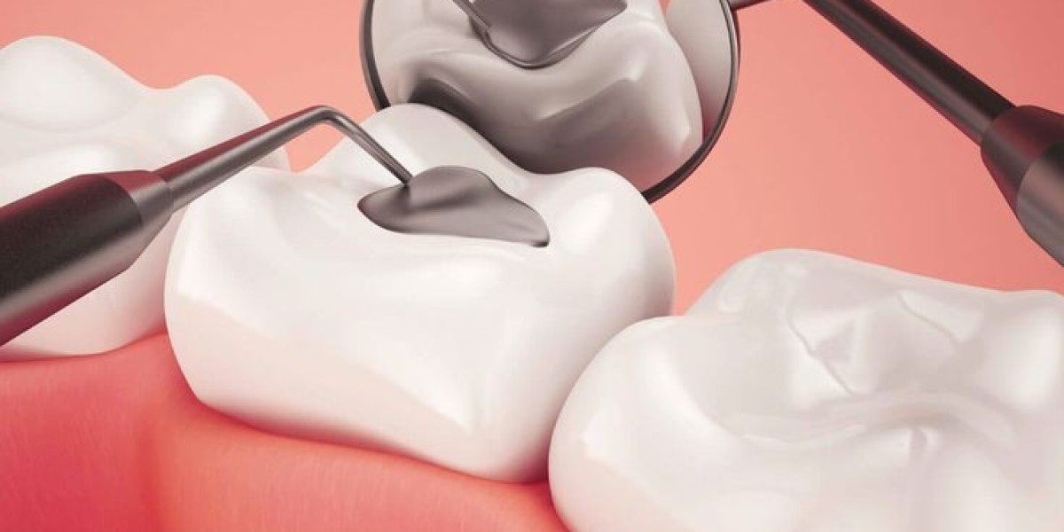 Tooth Filling Materials Market Future Outlook Shaping Innovations, Patient Care, and Global Dentistry Growth
