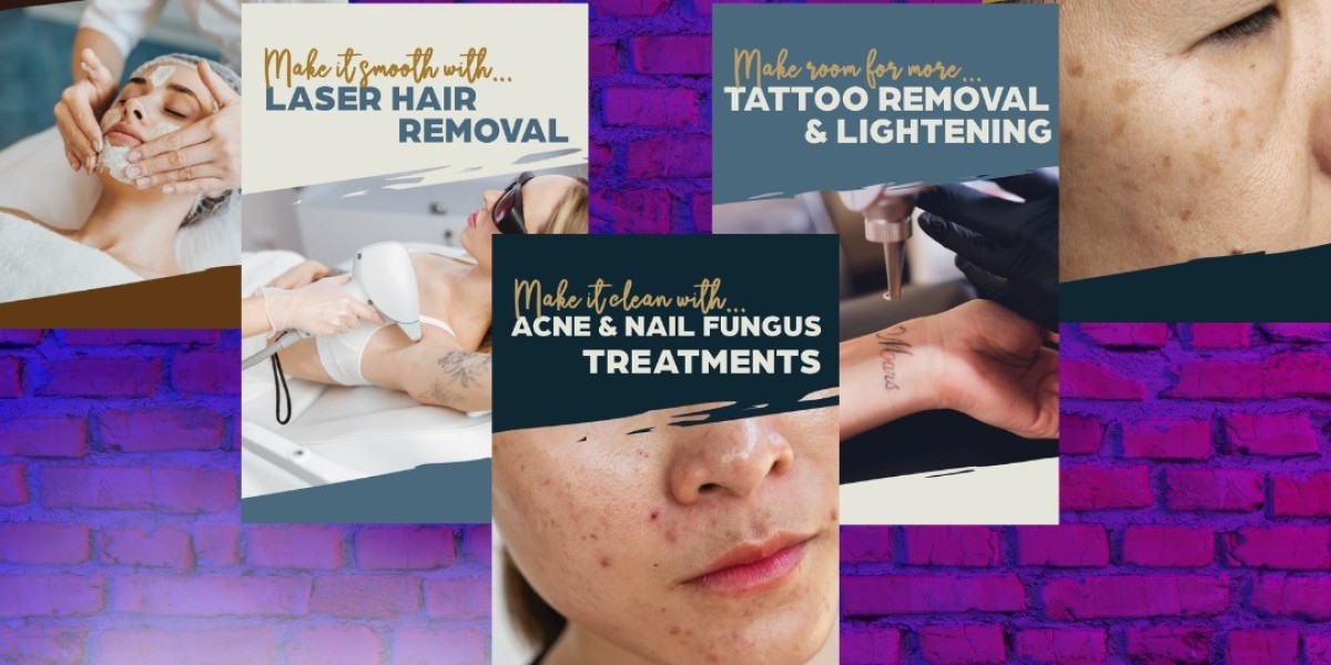 Laser Treatment Maintenance Sessions MN