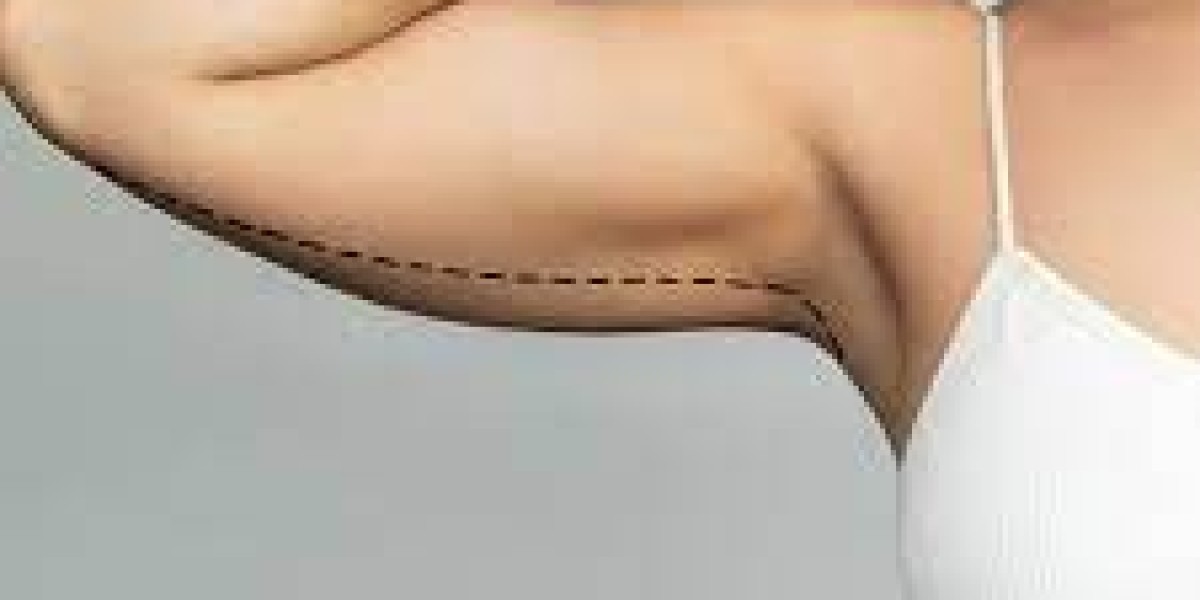 Say Goodbye to Sagging Arms: Everything About Arm Lift in Jeddah