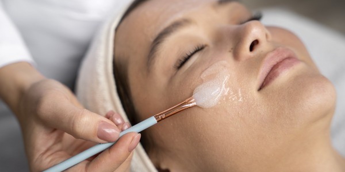 How Can Chemical Peels Improve Overall Skin Tone?
