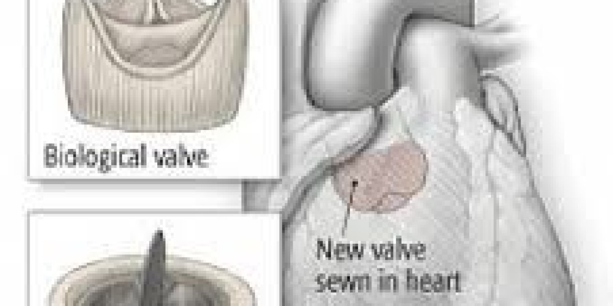 Prosthetic Heart Valves Market Cost Analysis & Affordability Trends