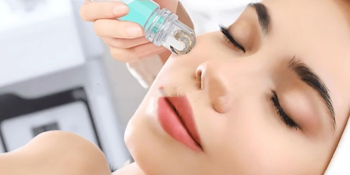 Step-by-Step Guide to Derma Pen Microneedling