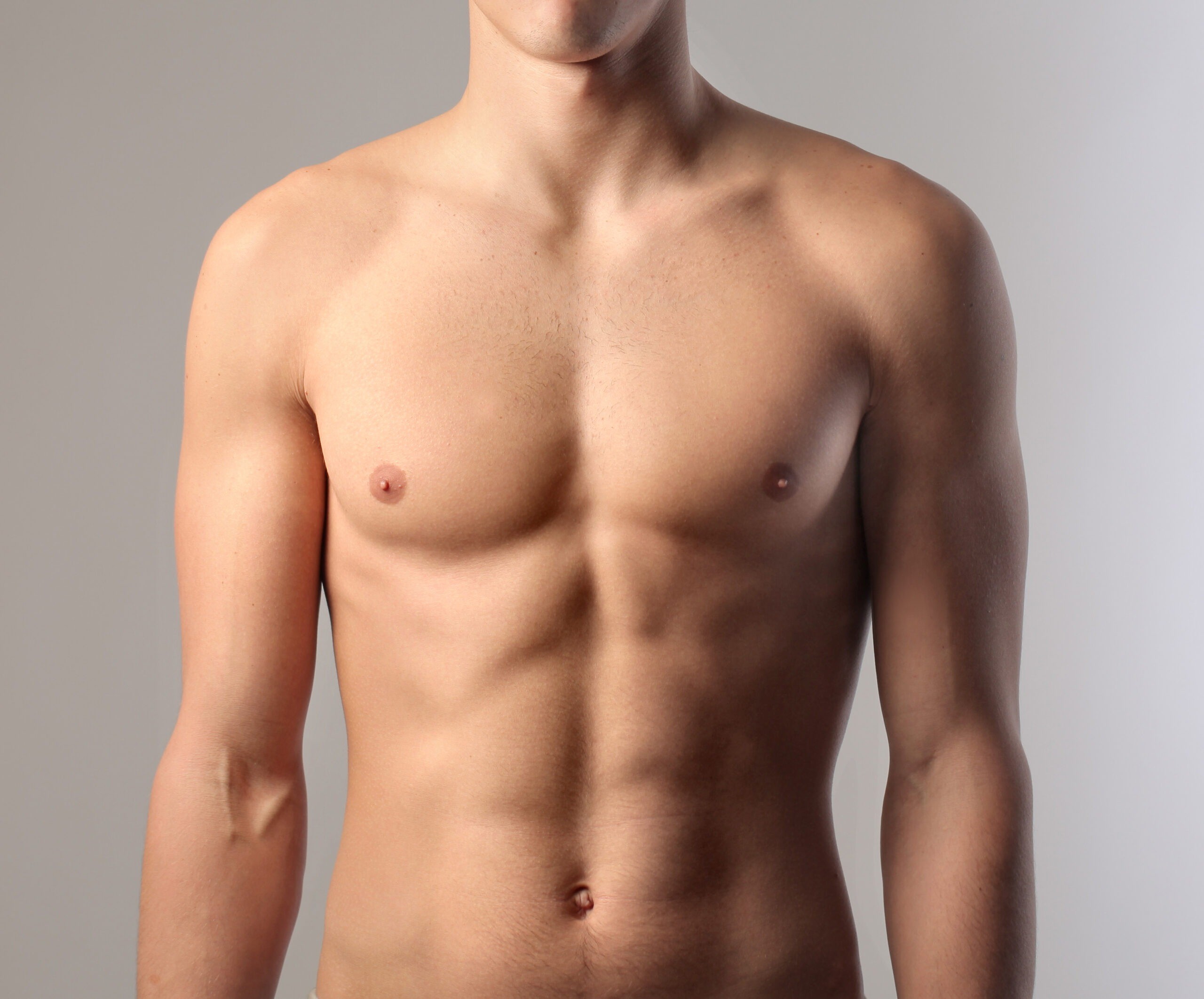 Gynecomastia