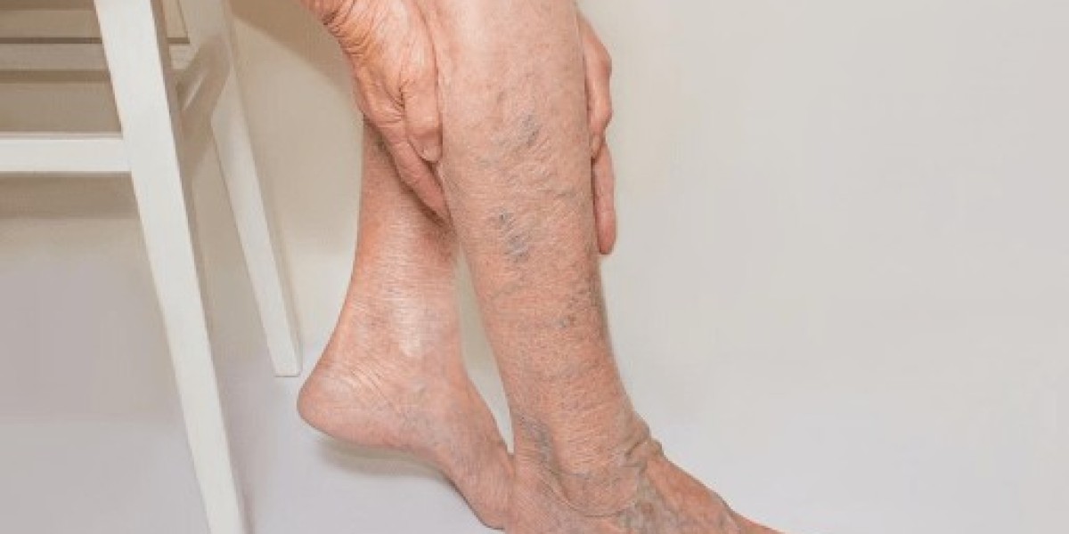 https://groups.google.com/g/venovixil-vein-care-cream-try/c/s1TZlOh5D6E