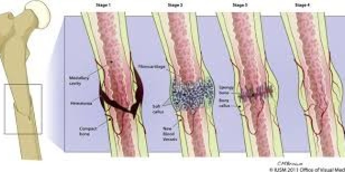 The Bone Regeneration Market forecast influenced by government initiatives promoting advanced healthcare treatments