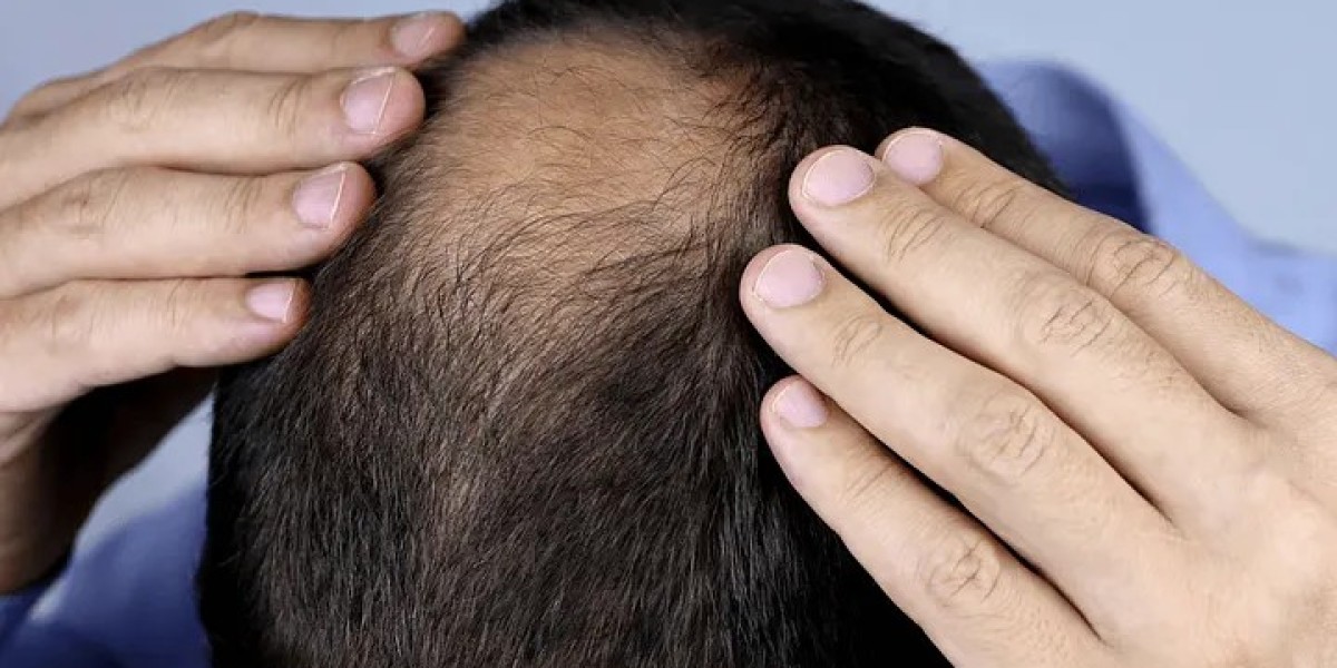 Which Hair Loss Treatments Are Suitable for All Ages?