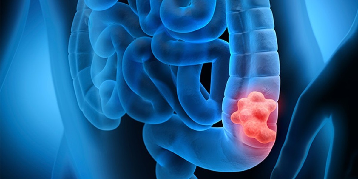 U.S. Colorectal Cancer Screening Market Size, Trends, and Growth Outlook