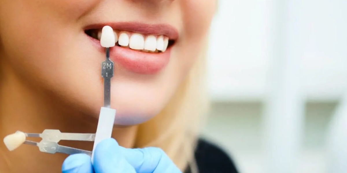 Can Dental Veneers Close Midline Tooth Gaps?