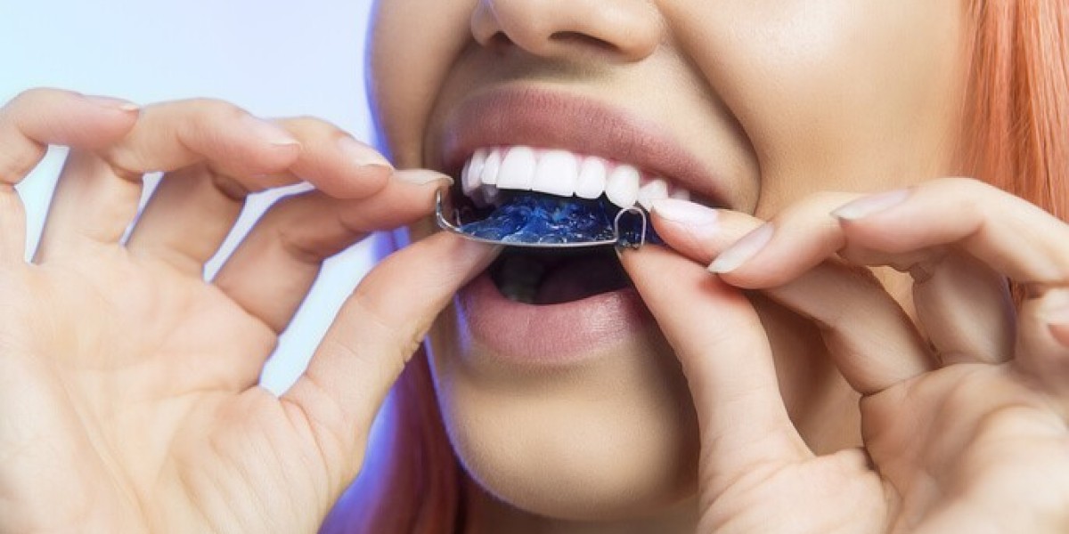 How Often Should You Visit the Dentist for Retainer Checks?