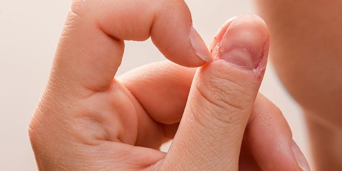 Therapist for Trichotillomania, CBT for Dermatillomania: Effective Treatments and Strategies
