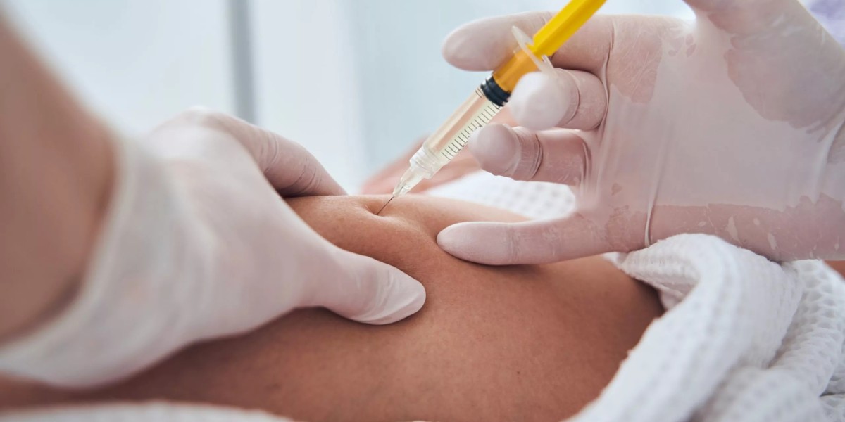 Precision Shape Control Comes Alive with Fat Melting Injections