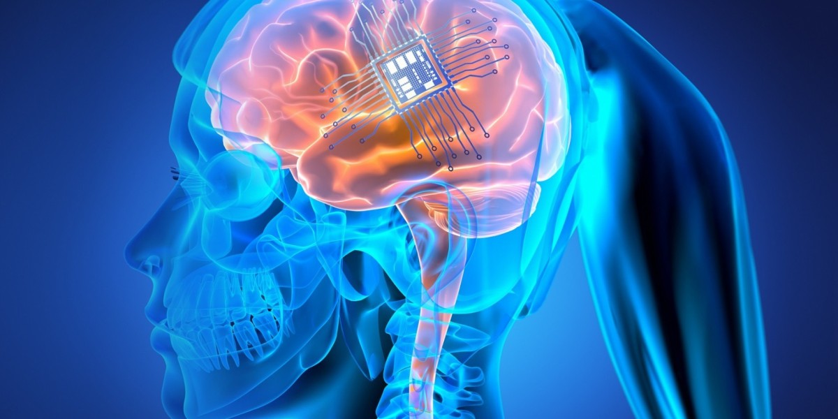 Brain Implants Market Outlook: Innovations in Neurotechnology and Therapeutics