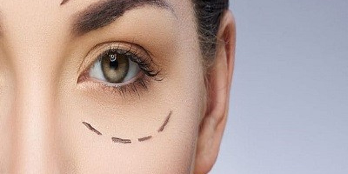 Men and Women Are Turning to Eyelid Surgery in Islamabad – Here’s Why