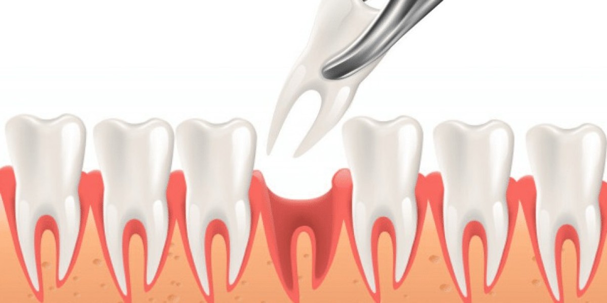 When Can Tooth Extraction Cost in Dubai Be Covered?