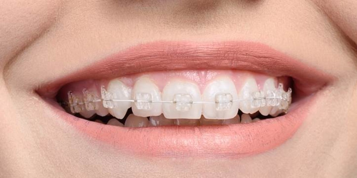 How to Make Ortho Appointments Fun for Kids