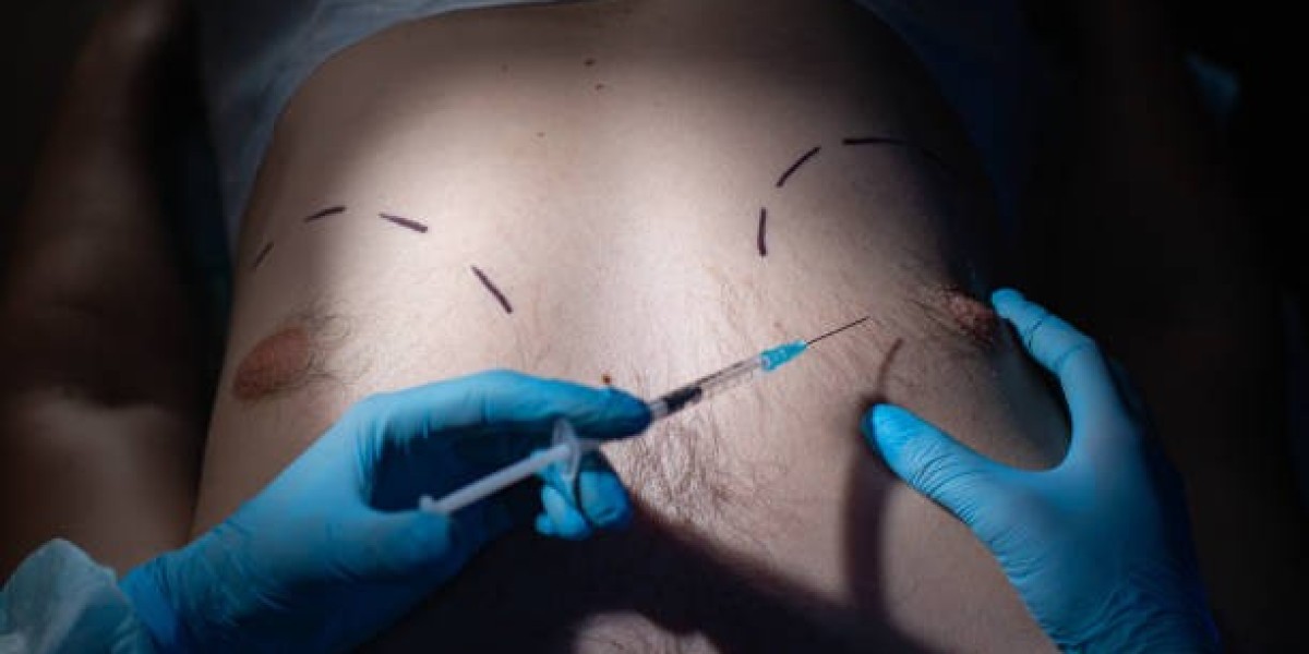 Gynaecomastia Surgery Dubai: Avoiding Common Surgery Risks