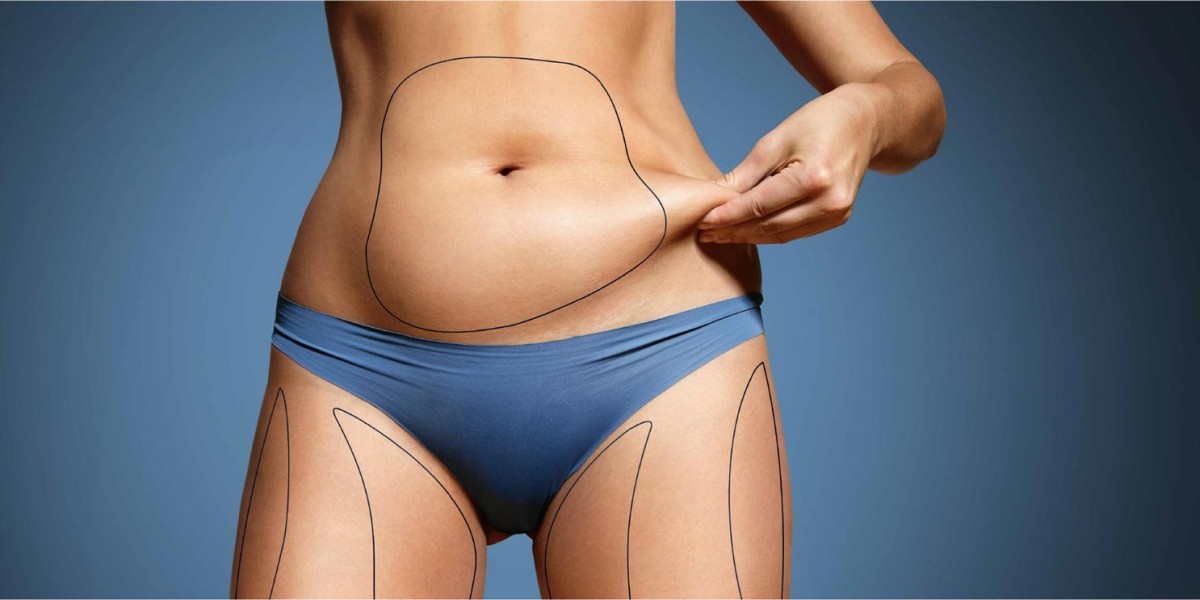 Abdominoplasty in Dubai: Why Experience Matters