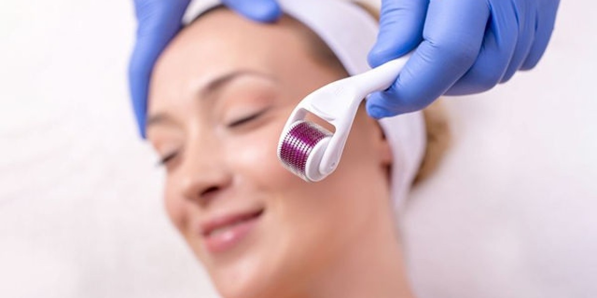What Are the Benefits of Microneedling With Rollers?