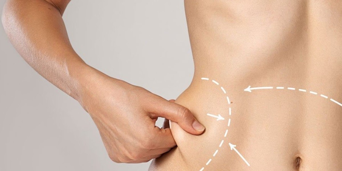 Do’s and Don’ts Before Your Liposuction Surgery in Islamabad