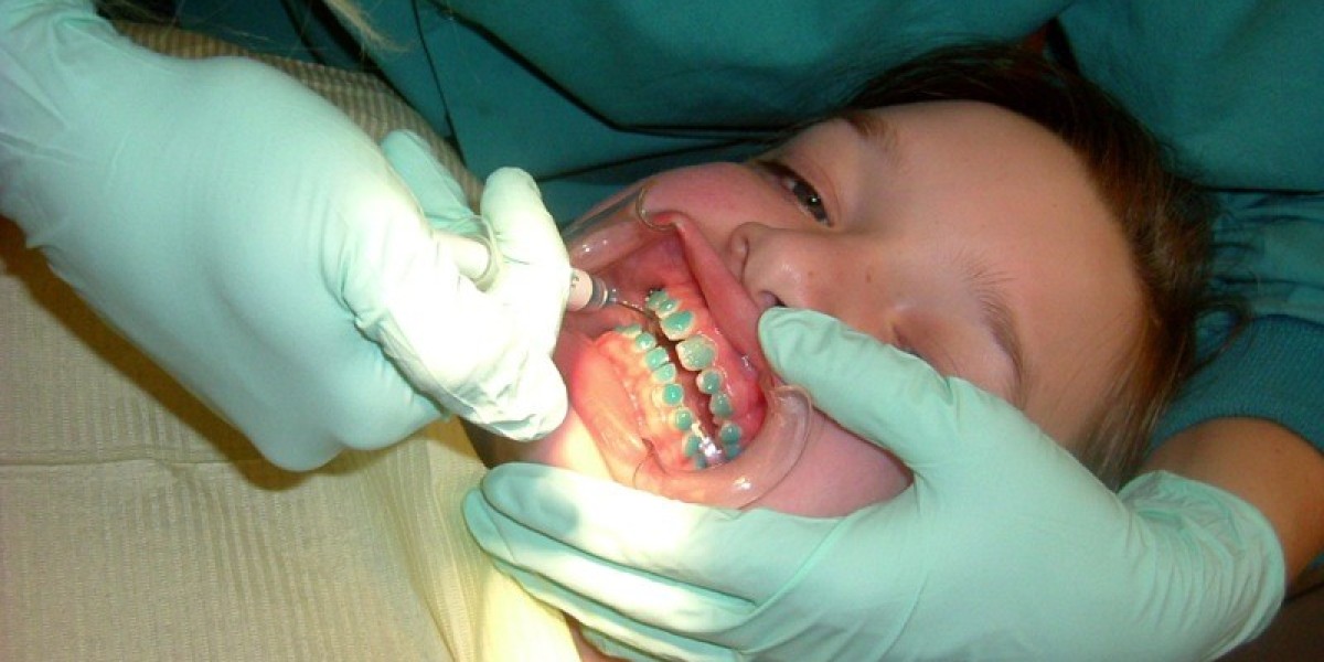 Orthodontist-Recommended Foods to Avoid with Braces