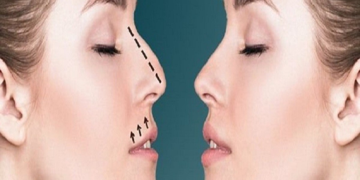 عملية تجميل الأنف في الرياض للرجال: أبرز التفاصيل
