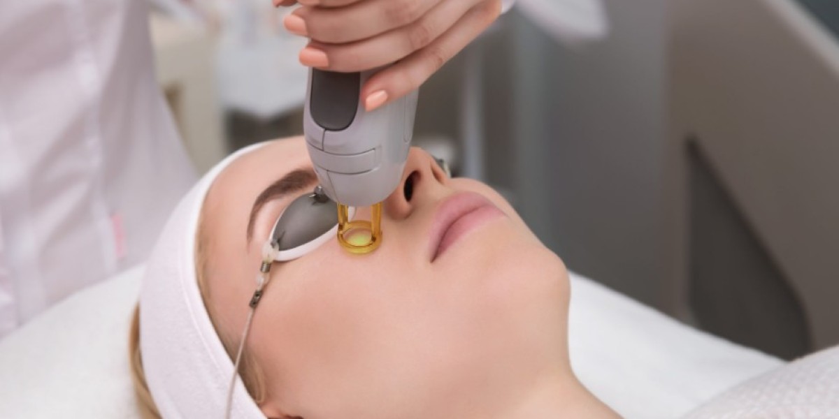 Revitalize Your Skin with CO2 Laser Treatments at Vitality Healthcare Group
