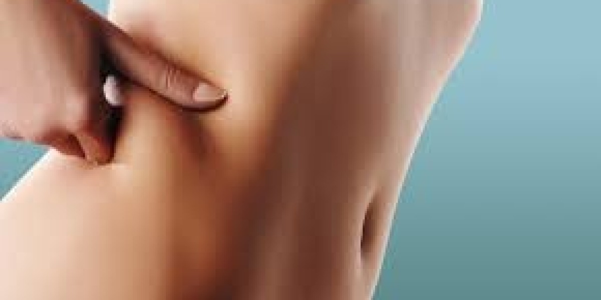 Transform Your Body with Weight Loss Injections in Islamabad