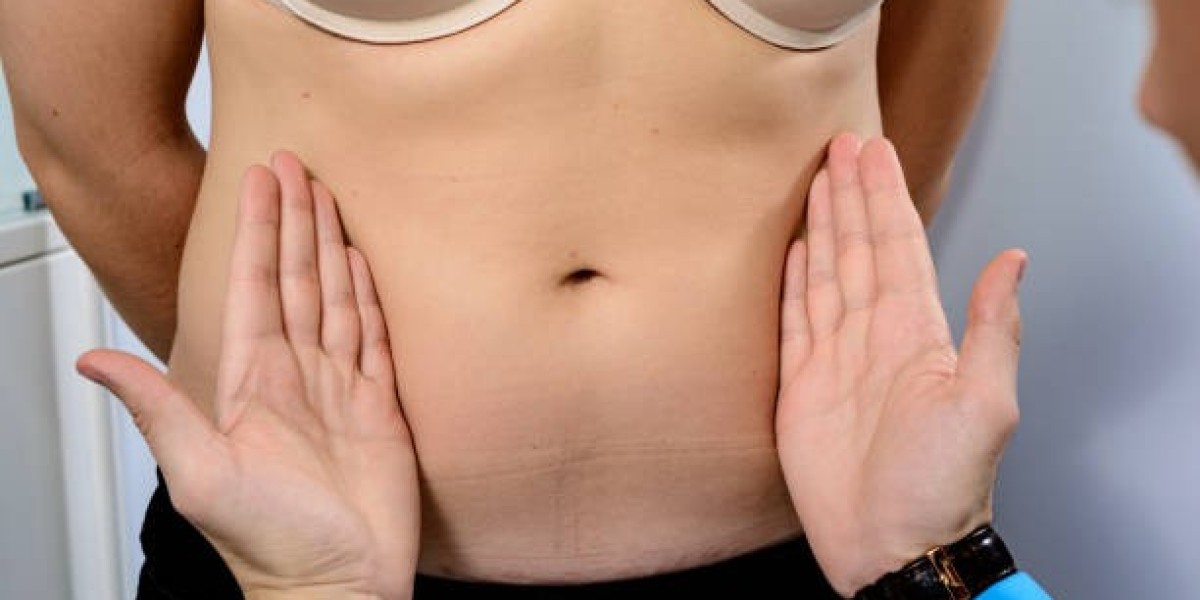 Top 7 Tips for a Successful Mini Abdominoplasty Dubai