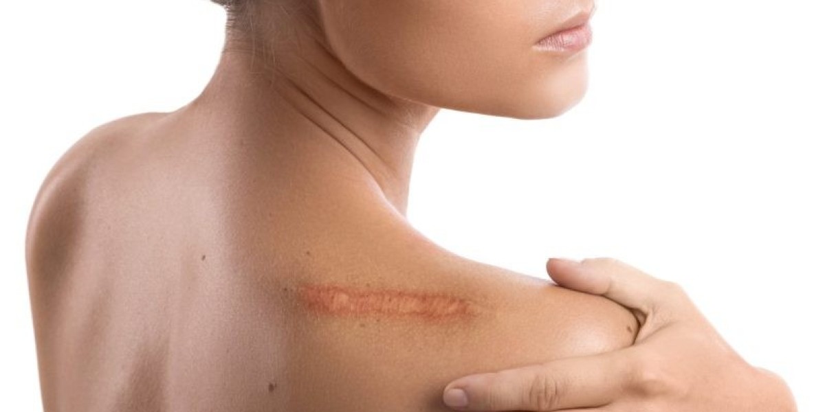 Discover Confidence with Surgical Scar Revision