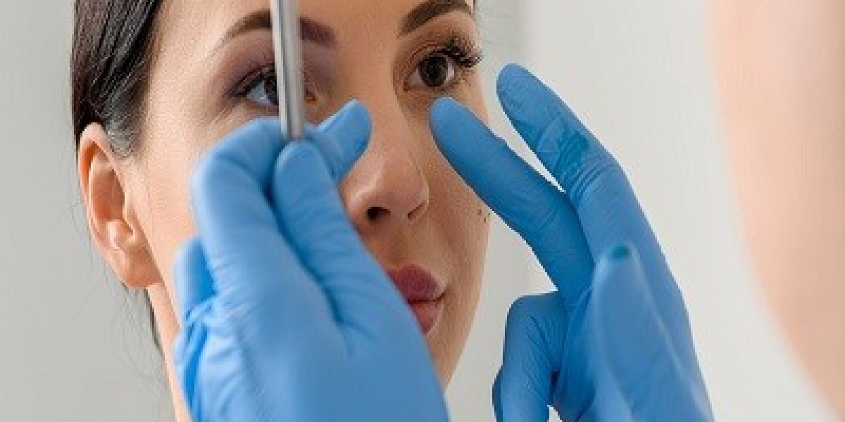 How to Minimize Swelling After Alarplasty in Islamabad