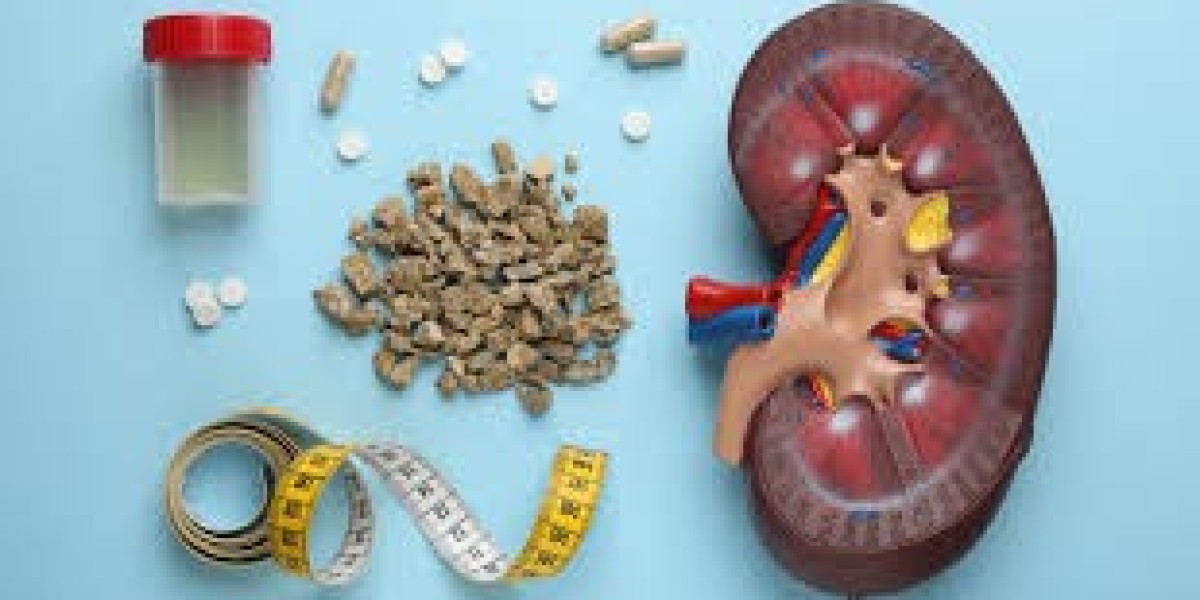 Finding the Best Hospital for Kidney Stones Treatment and Specialist Care