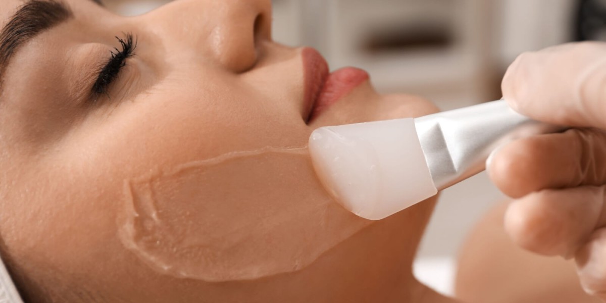 What are the Benefits of PCA Peel Treatment ?